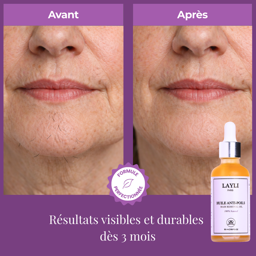 HUILE ANTI-POILS NUIT • disparition définitive des poils !