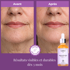 HUILE ANTI-POILS NUIT • disparition définitive des poils !